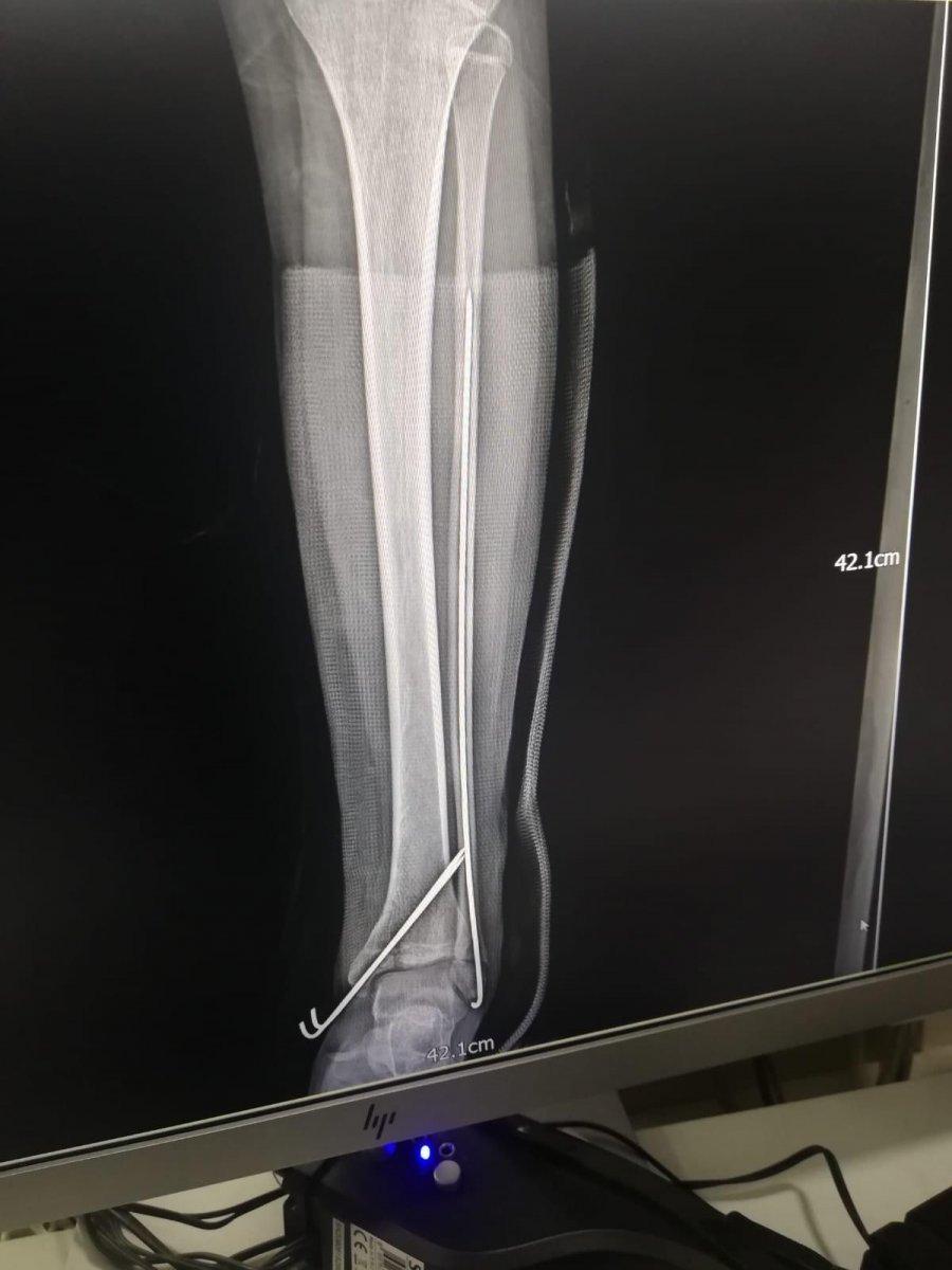 İstanbul'da 12 yaşındaki kızın pencereden atladığı anlara ait görüntüler ortaya çıktı