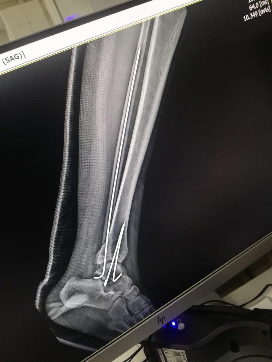 İstanbul'da 12 yaşındaki kızın pencereden atladığı anlara ait görüntüler ortaya çıktı