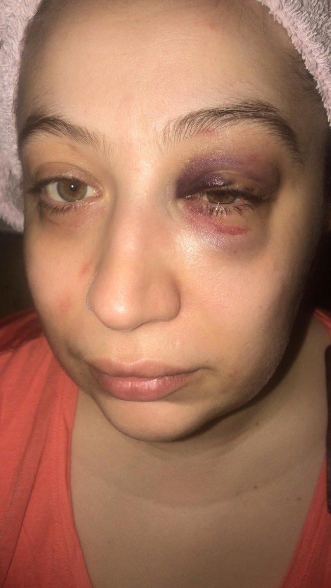 Bakırköy’de eşini darbeden eski koca, suçlamaları reddetti: Her şeyi kendisi kurdu