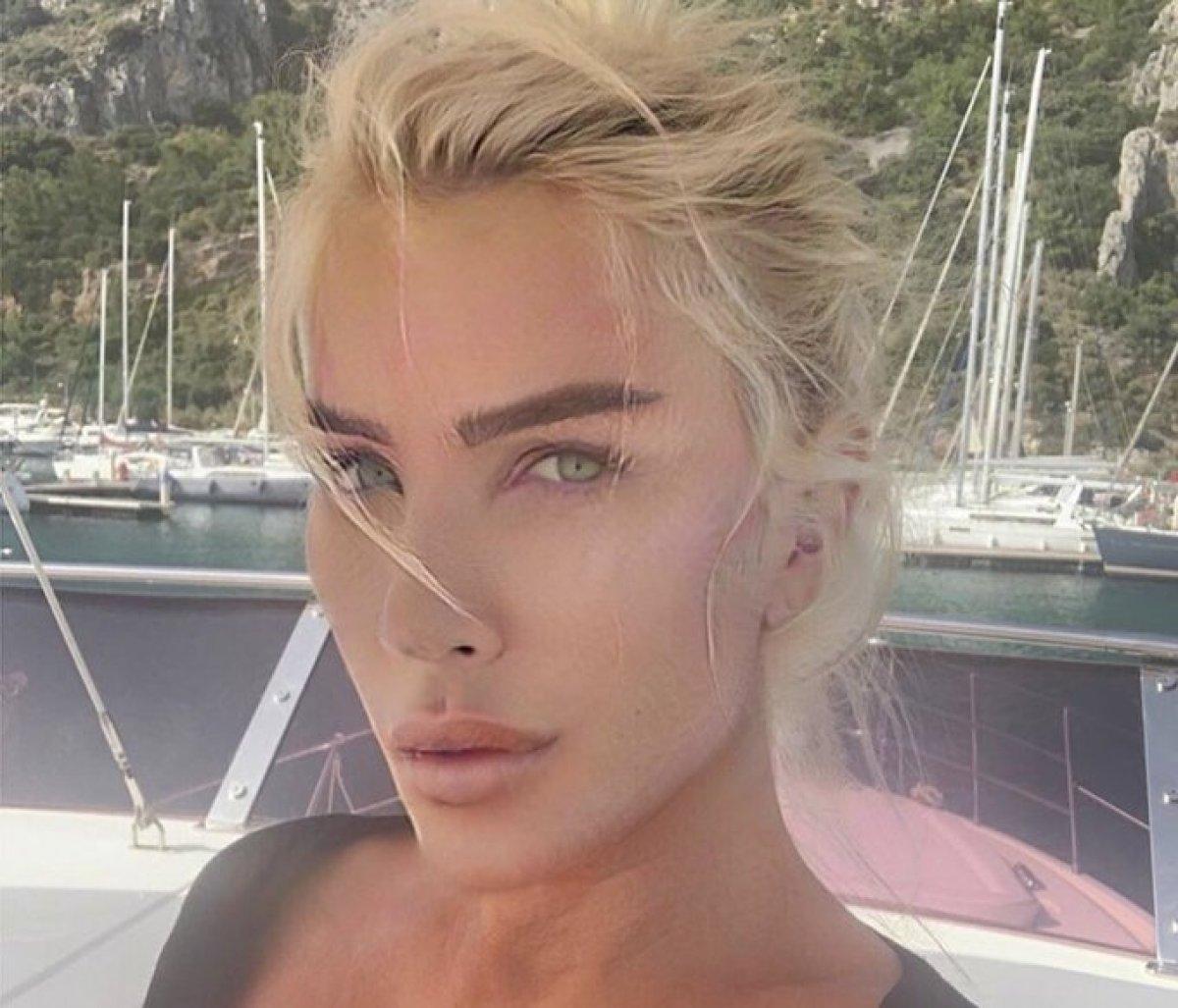 Seda Sayan'ın son hali