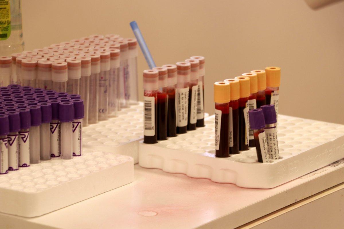 İmmün plazma nedir? İmmün plazma tedavisi nasıl yapılır? Gerekli koşullar nelerdir?