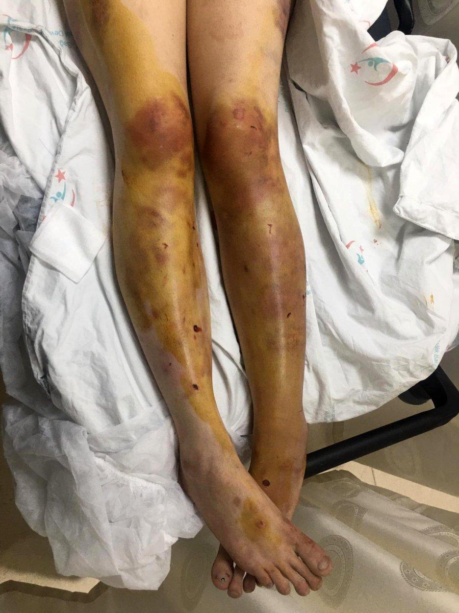 Şanlıurfa'da, dini nikahlı eşine işkence eden cani