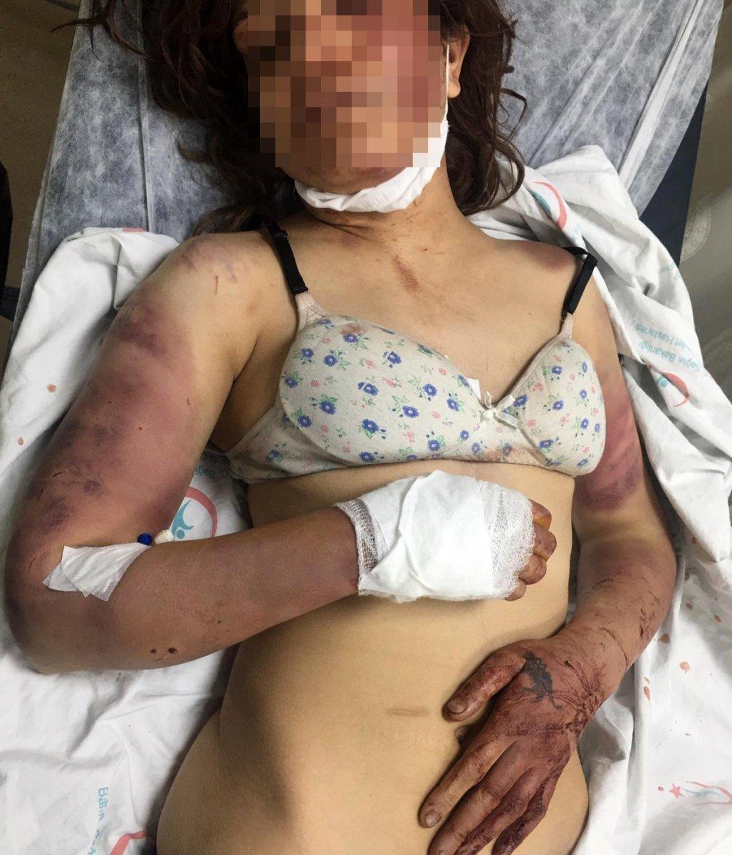 Şanlıurfa'da, dini nikahlı eşine işkence eden cani