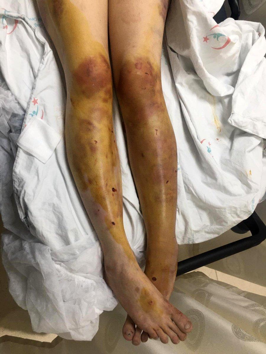 Şanlıurfa eş işkence