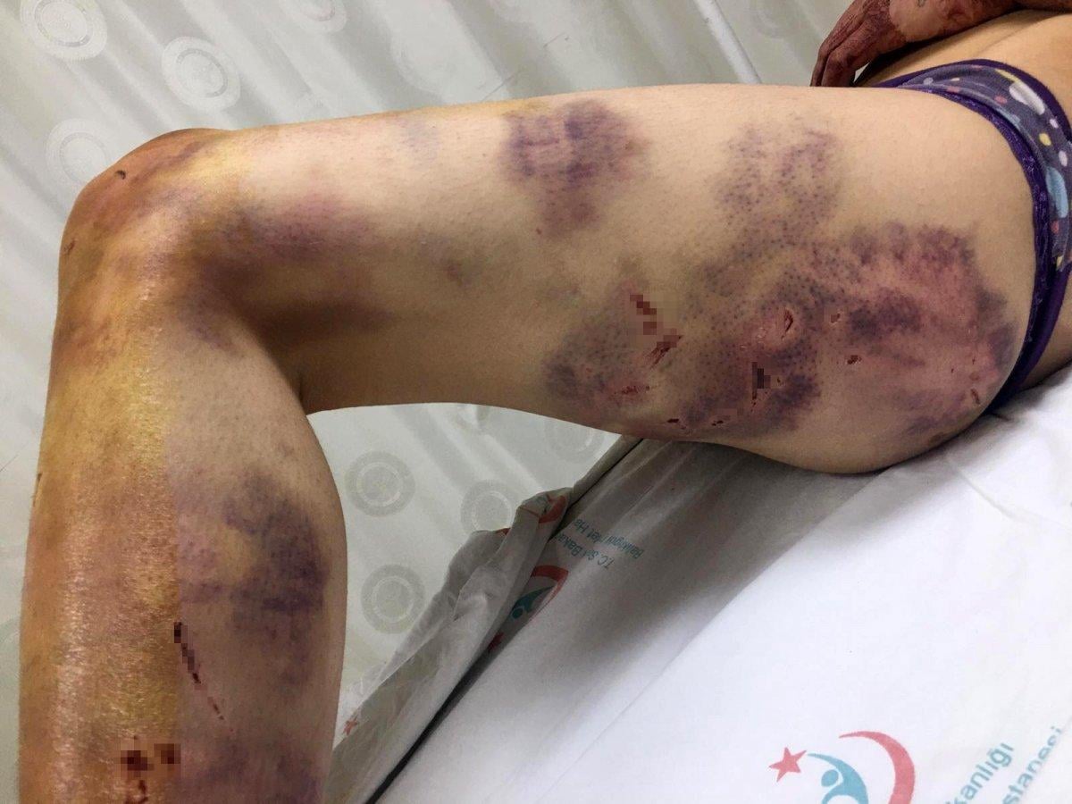 Şanlıurfa eş işkence