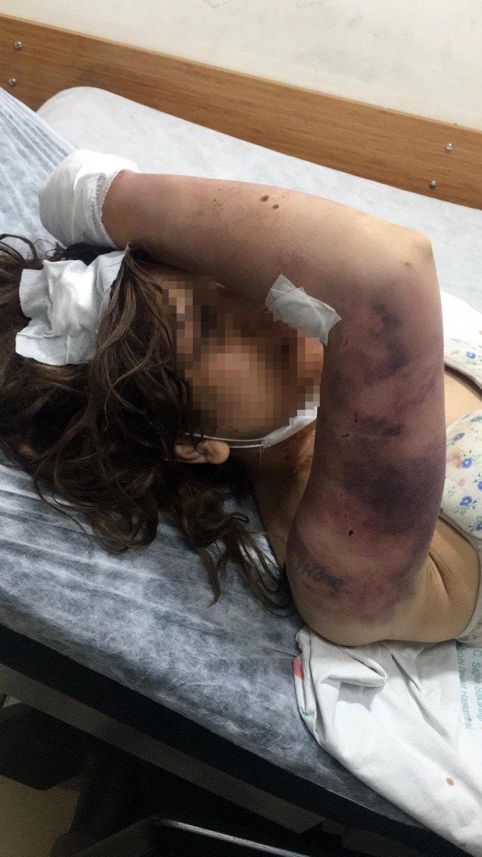 Şanlıurfa eş işkence