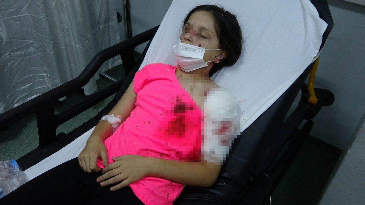 Samsun'da pitbull cinsi köpekler, 11 yaşındaki Tuğba'ya saldırdı