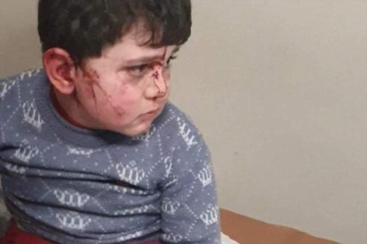 Ermenistan'dan Hocalı Katliamı'nı anımsatan saldırı