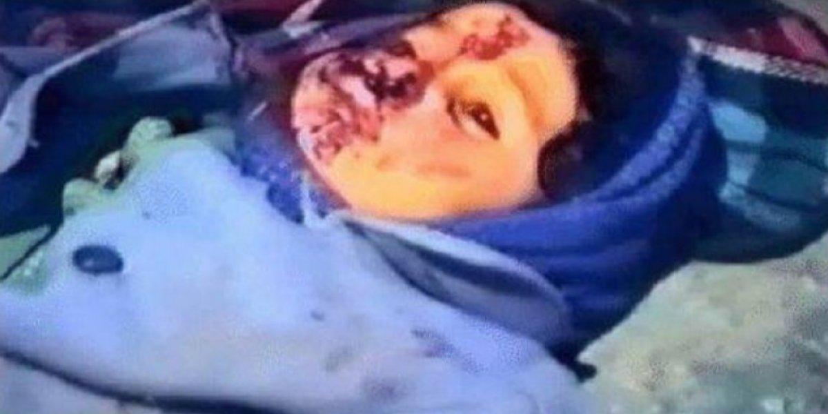 Ermenistan'dan Hocalı Katliamı'nı anımsatan saldırı