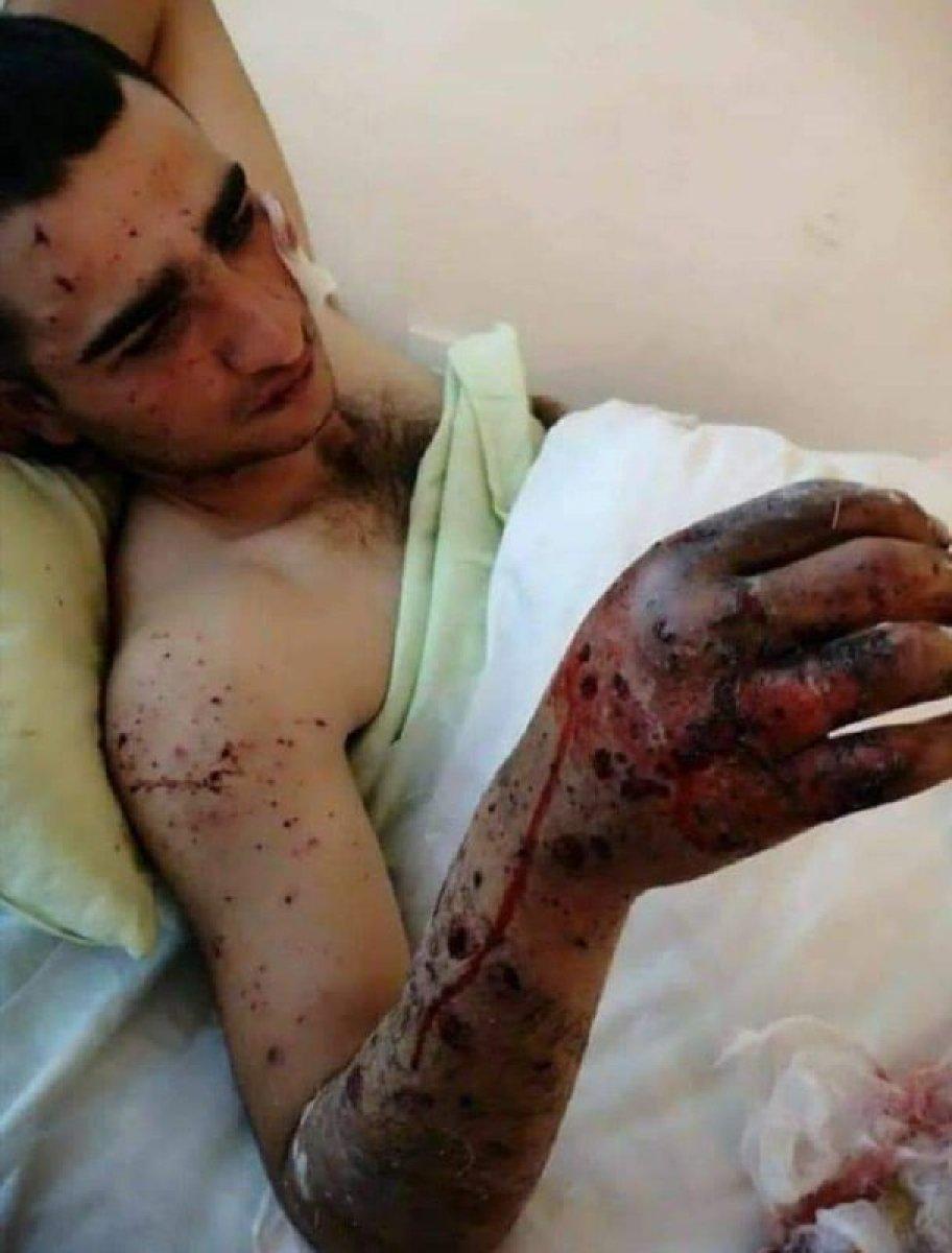 Ermenistan'dan Hocalı Katliamı'nı anımsatan saldırı