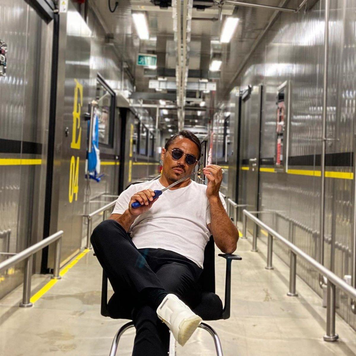 Nusret’in ellerinde nasır çıktı