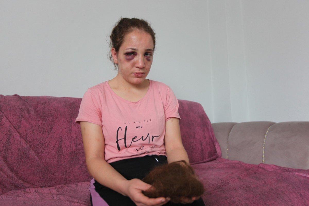 Aydın'da kocasından şiddet gören genç kadın yardım istiyor