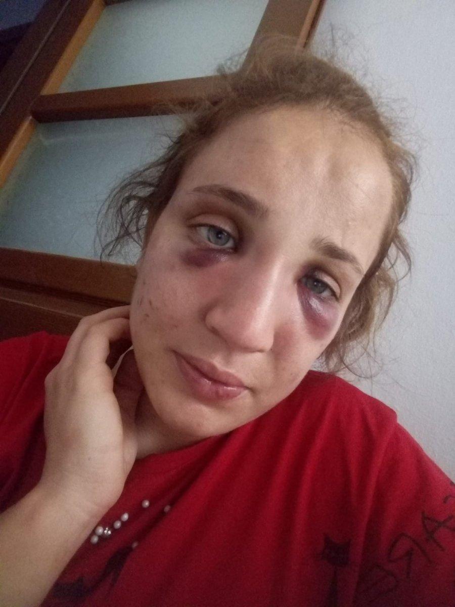 Aydın'da kocasından şiddet gören genç kadın yardım istiyor