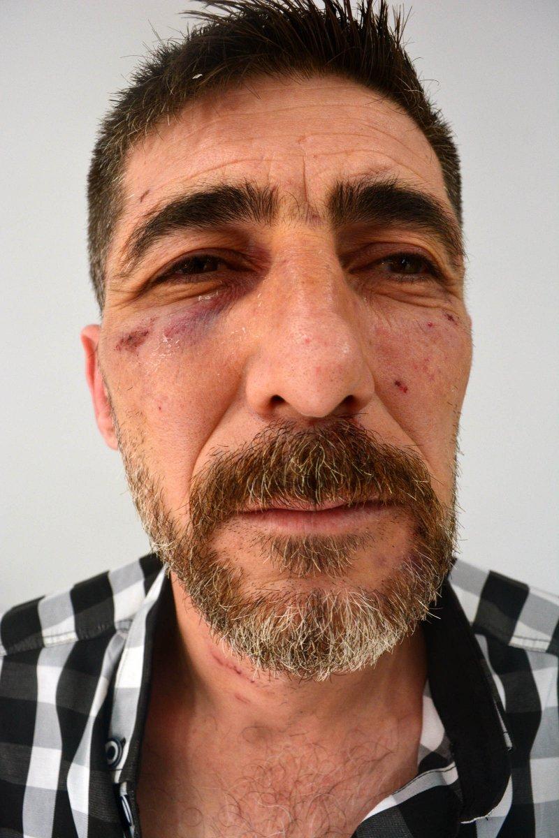 Samsun'da bir kişiyi gözaltına alan bekçilere soruşturma