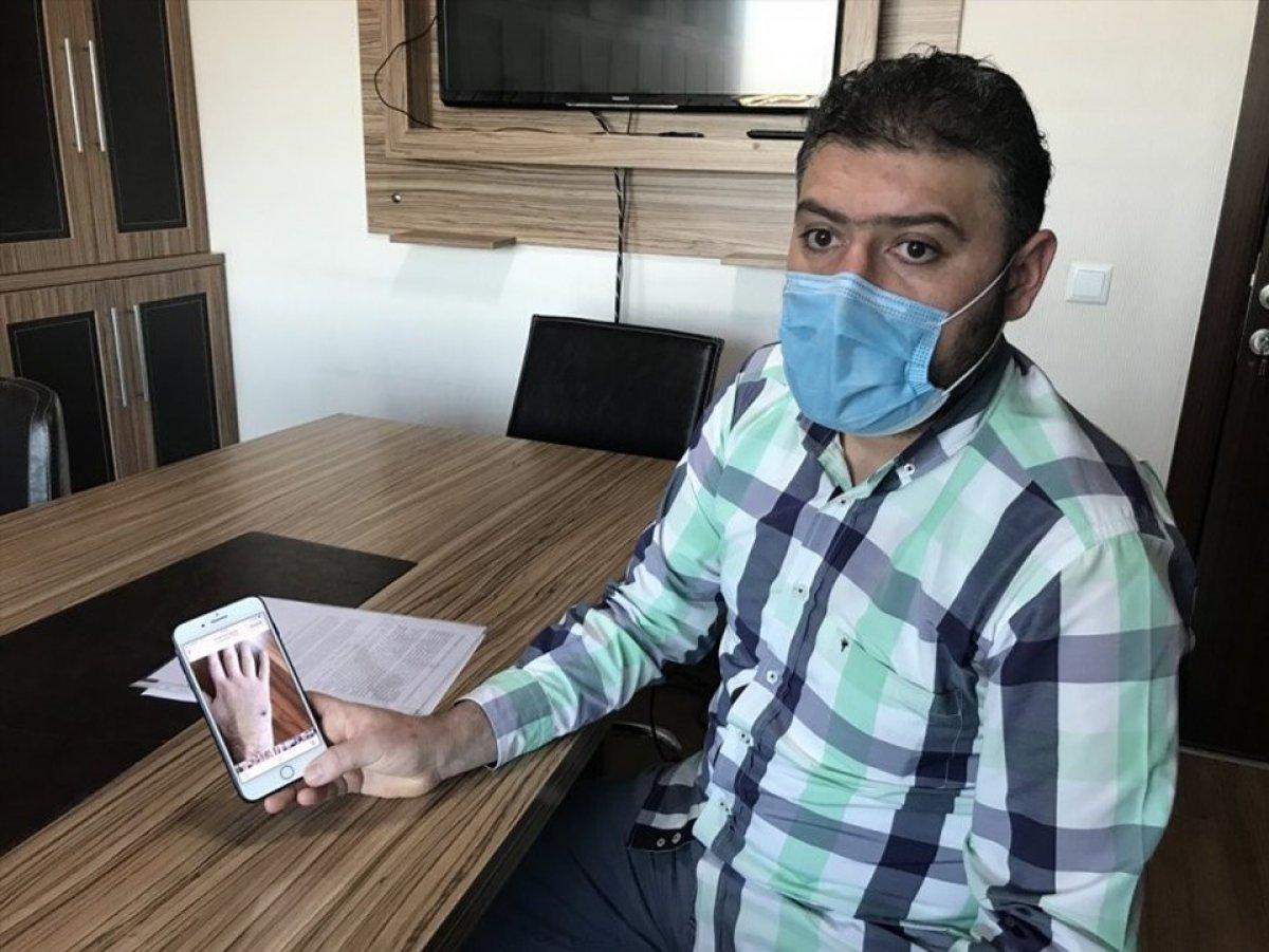 Konya'da sokak köpeklerinin ısırdığı kişinin belediyeye açtığı davasında emsal karar