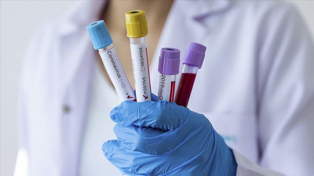 Korkutan araştırma: Koronavirüs sonrası IQ düşüyor