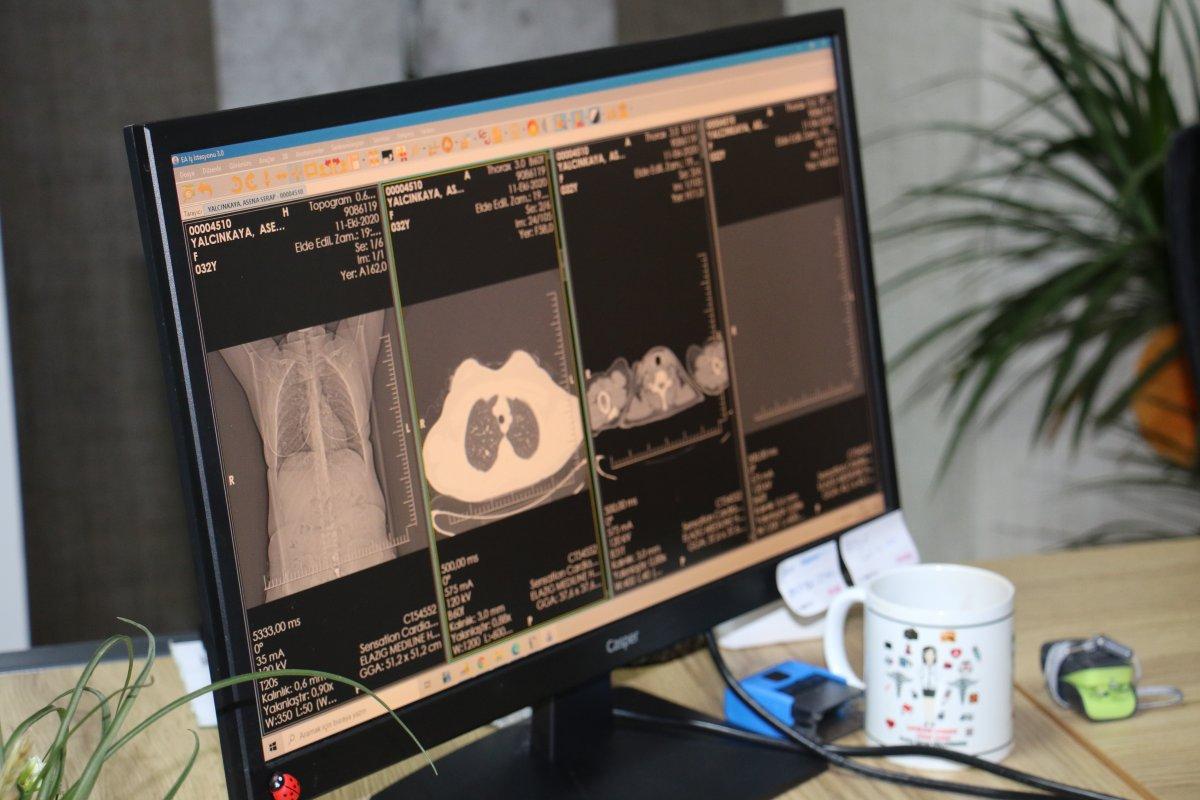 Elazığ'da koronavirüsü yenen doktor 5 gününü hatırlamıyor