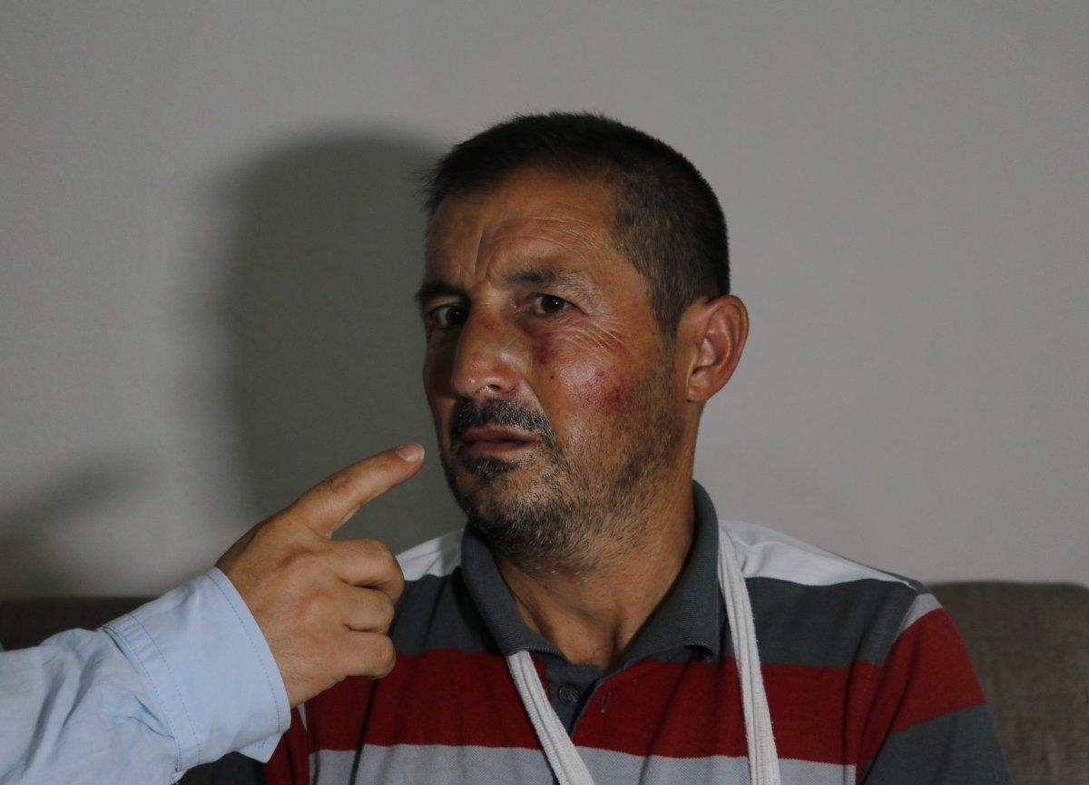 Adana’da işitme engelli adama feci dayak