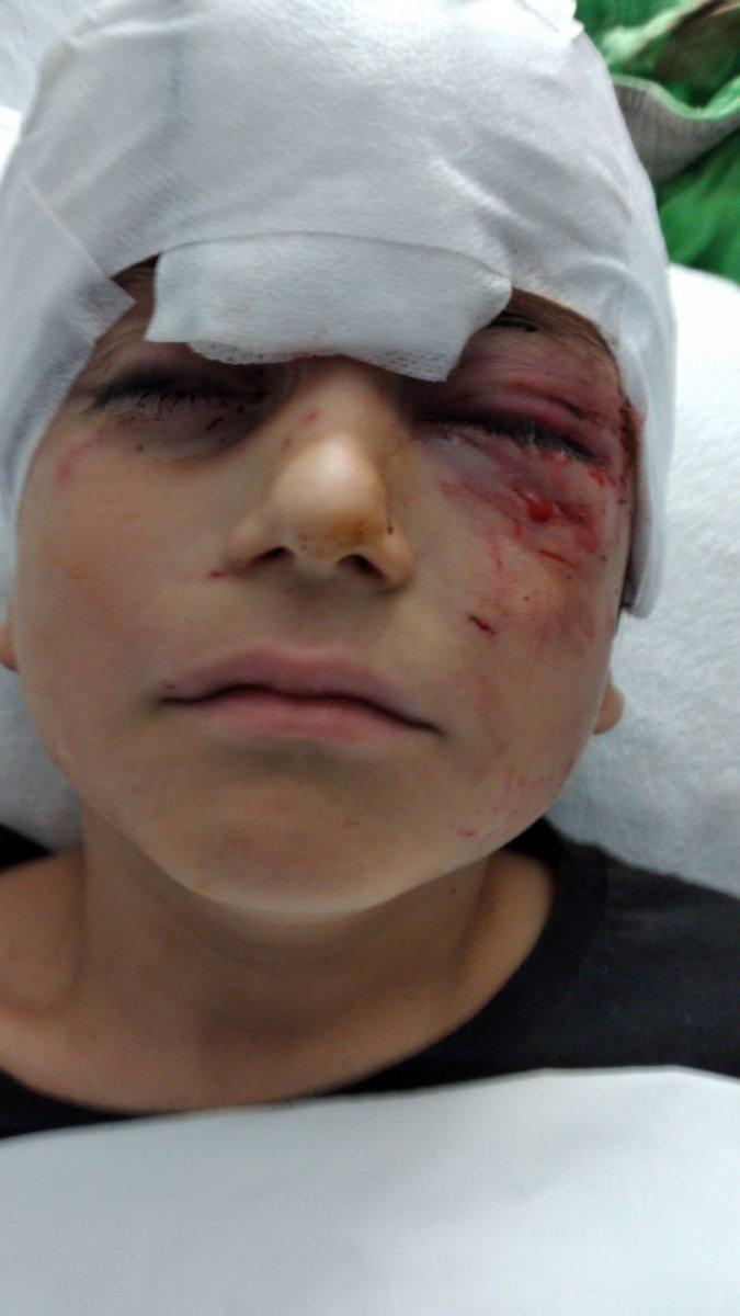 Kocaeli'de 8 yaşındaki çocuğa kangal saldırdı