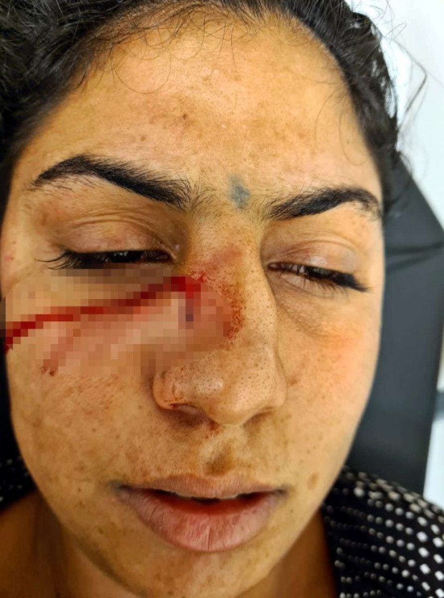 Adana'da dini nikahlı eşini darbedip bıçaklayan koca tutuklandı