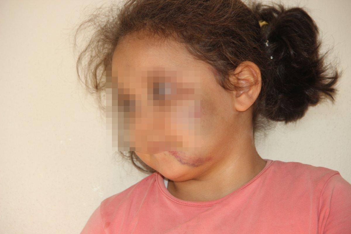 Şanlıurfa'da muska yapıldığı iddiasıyla çocuklarına şiddet uyguladı