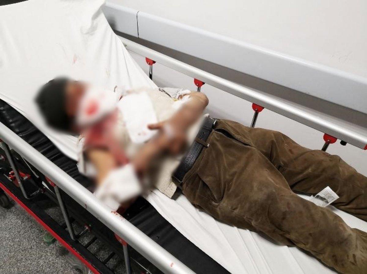 Aksaray'da komşusunun köpeği tarafından saldırıya uğradı