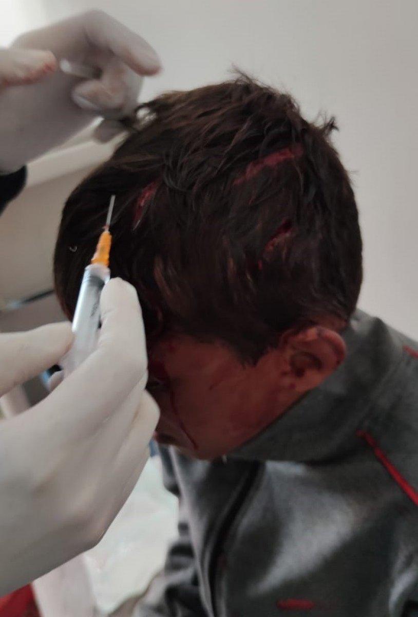 Van’da 10 yaşındaki çocuğa öldüresiye dayak