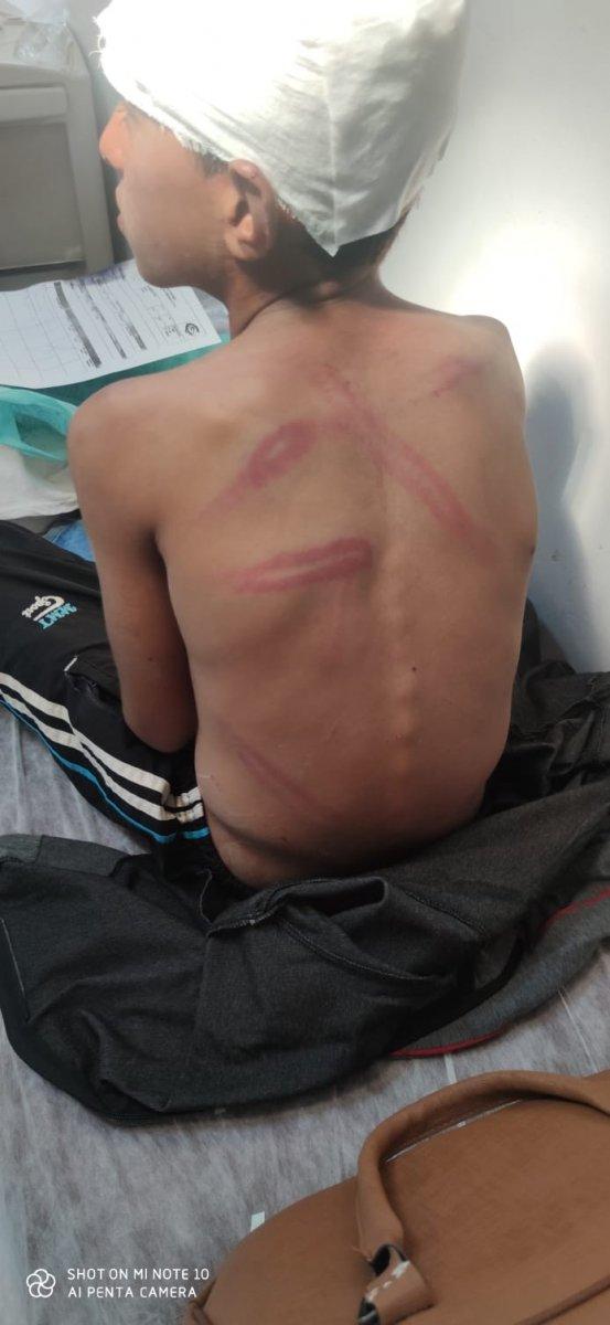 Van’da 10 yaşındaki çocuğa öldüresiye dayak