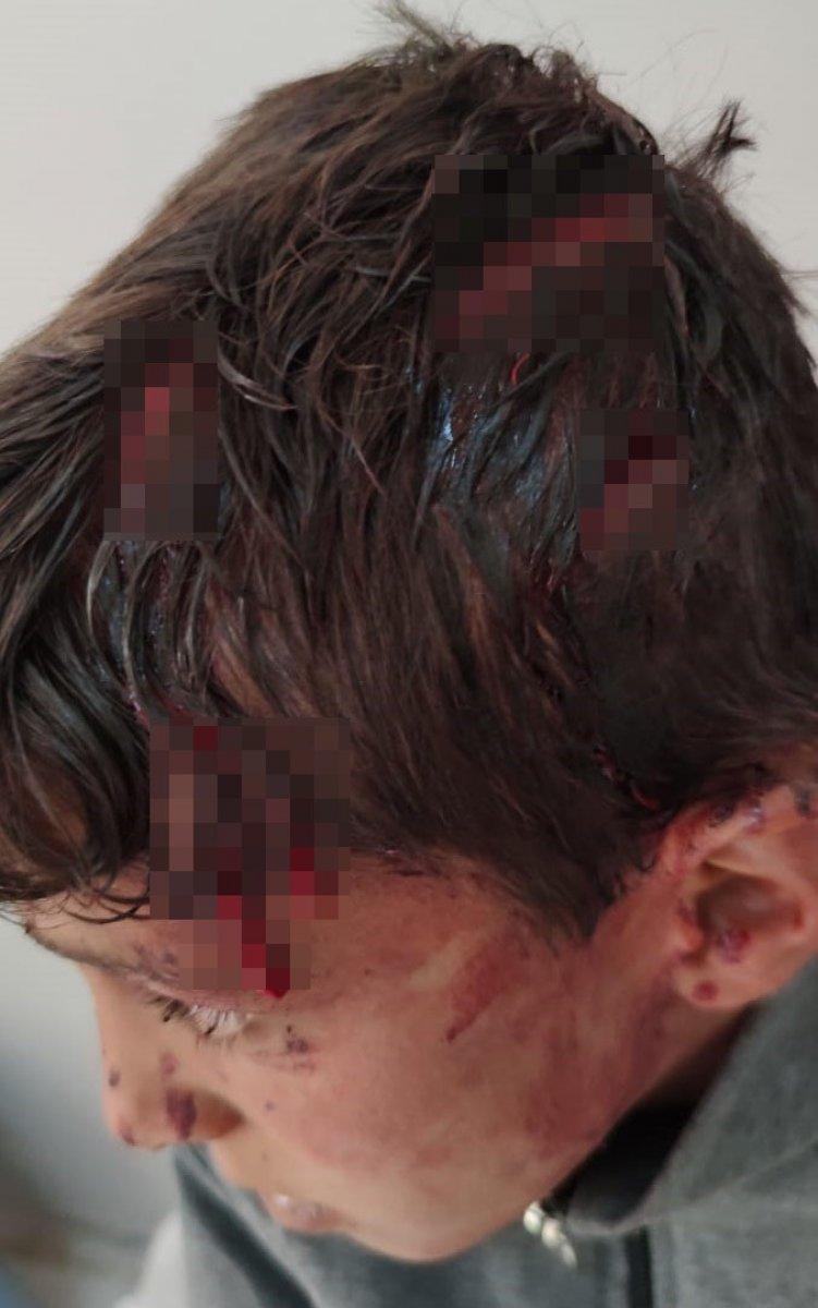 Van’da 10 yaşındaki çocuğa öldüresiye dayak