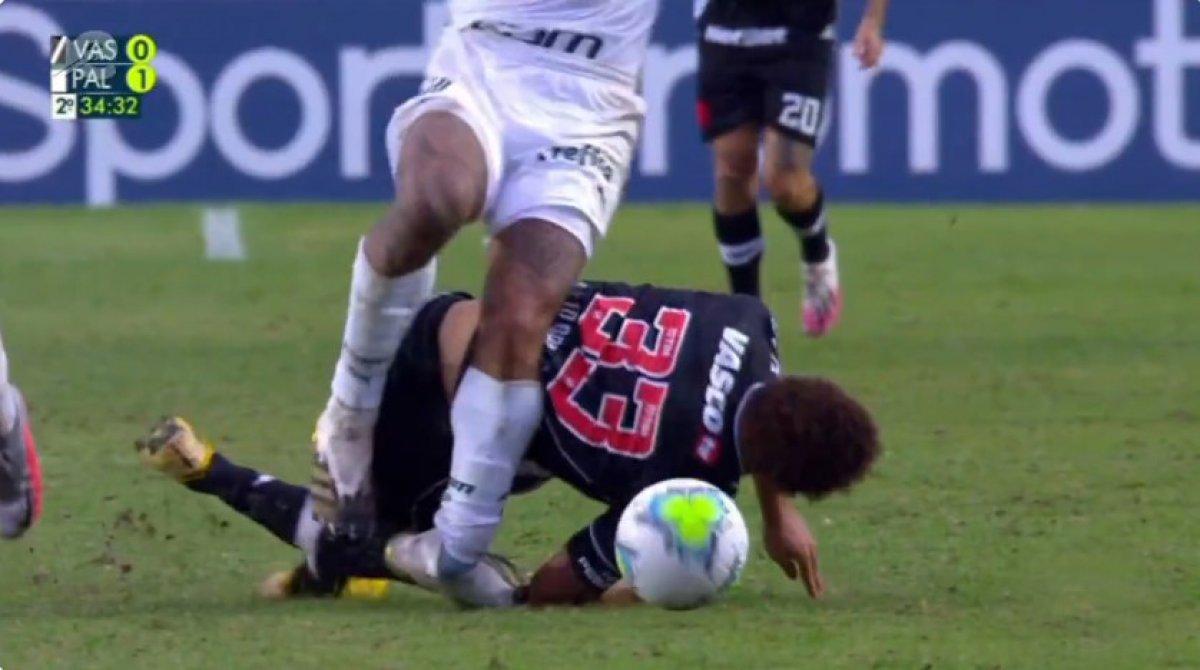 Felipe Melo'nun ayağı kırıldı