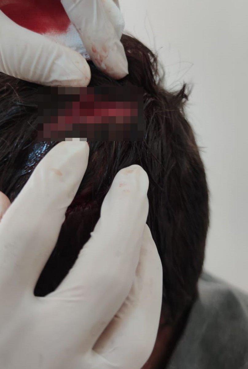 Van’da 10 yaşındaki çocuğa öldüresiye dayak