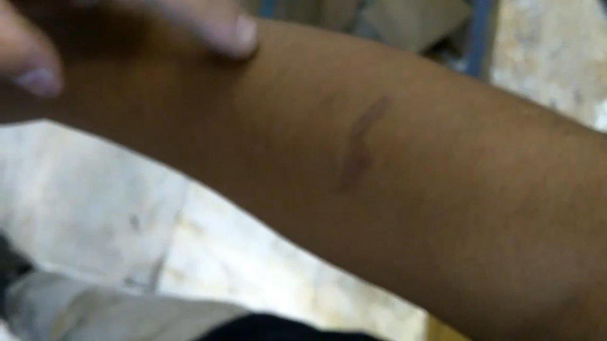 İstanbul'da, beyin ameliyatı geçiren çocuğa dayak ve işkence iddiası