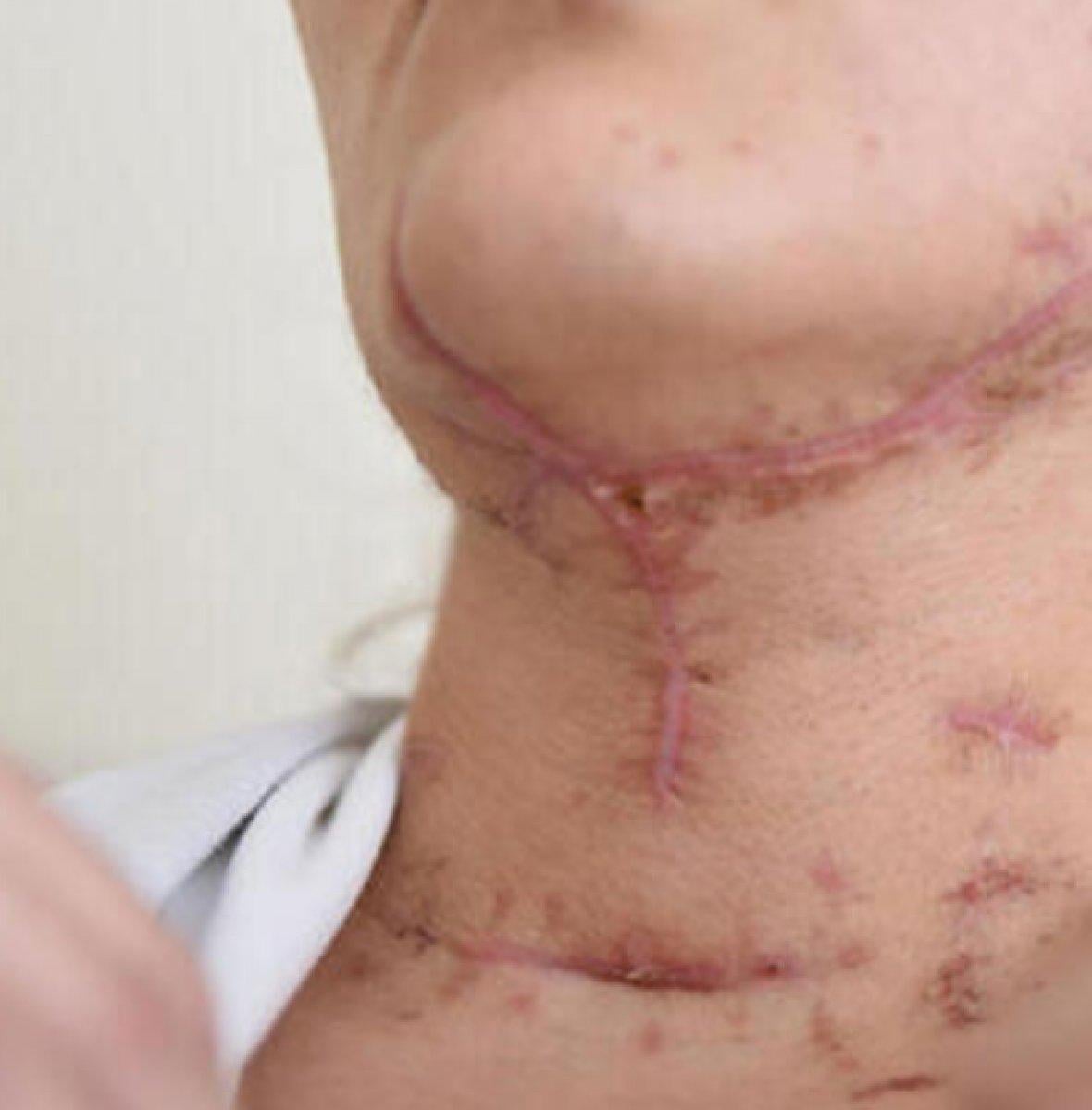 Avcılar'daki falçatalı cinsel istismar davasında istenen ceza belli oldu