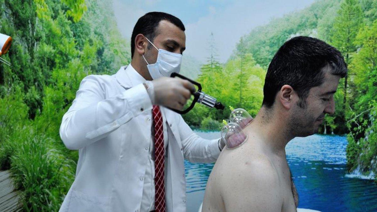 Hacamat nedir, nasıl yapılır? Hacamat hangi günler yapılır? Hacamatın faydaları nelerdir?