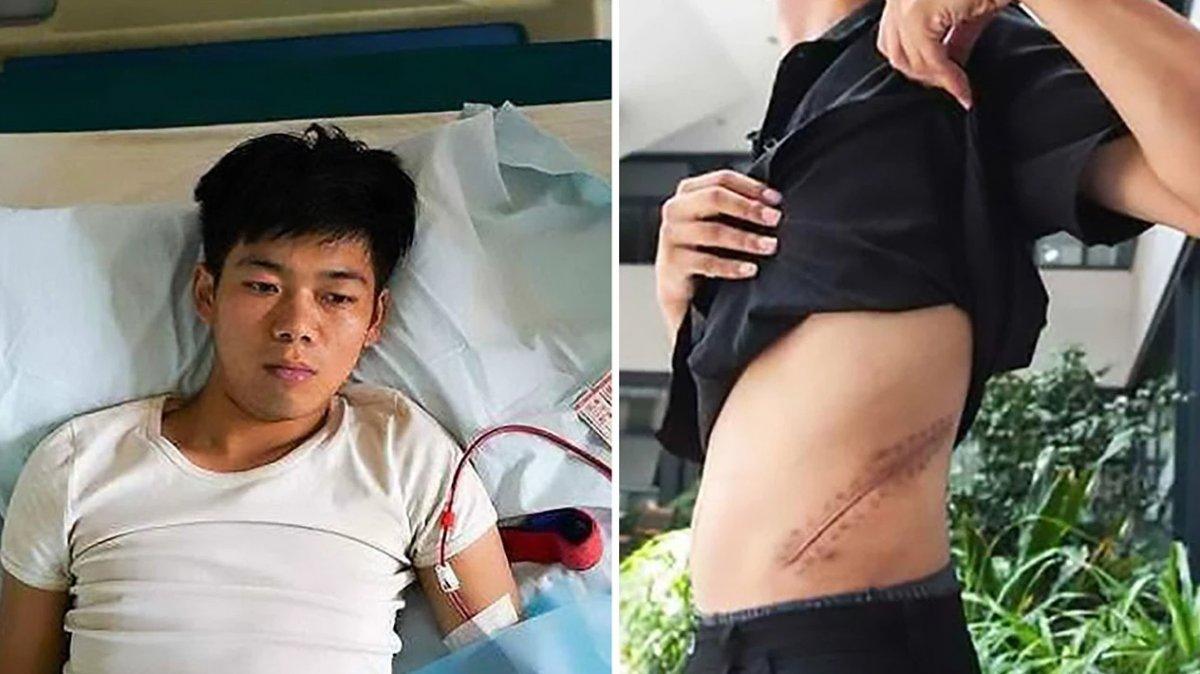 Çin'de iPhone almak için böbreğini sattı, yatalak kaldı