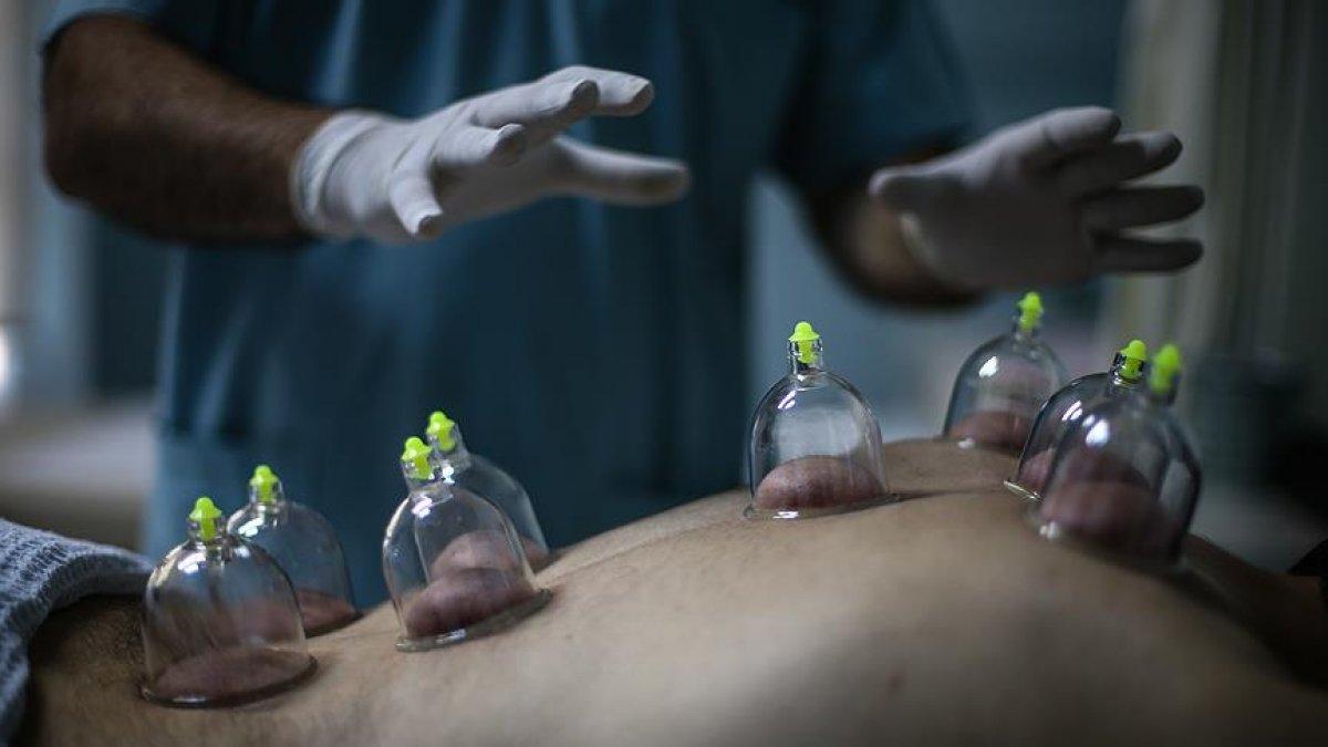 Hacamat nedir, nasıl yapılır? Hacamat hangi günler yapılır? Hacamatın faydaları nelerdir?