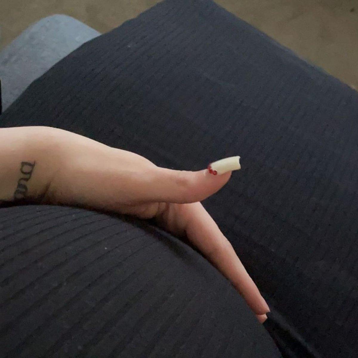 ABD'de kadın üreme organlarıyla erkek olarak doğdu, hamile kaldı