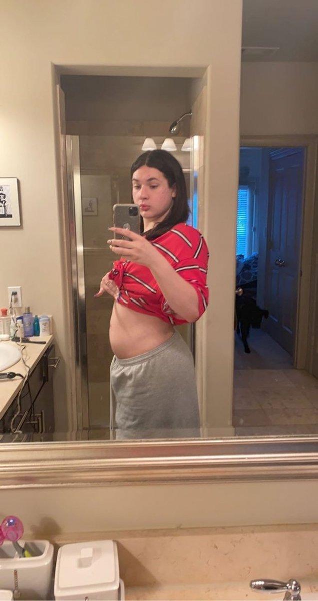 ABD'de kadın üreme organlarıyla erkek olarak doğdu, hamile kaldı