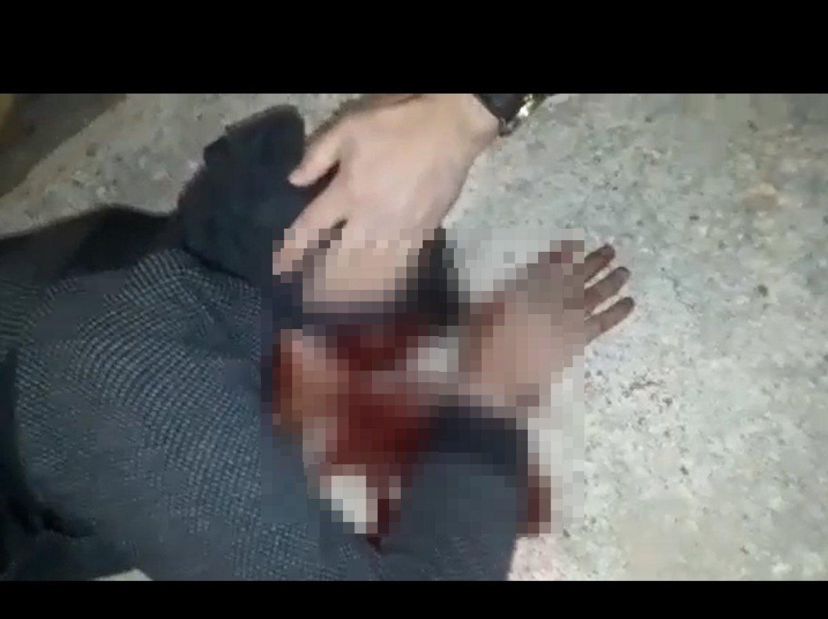 Çorum’da eşinin akrabalarına silahla saldırdı: 1 ölü, 3 yaralı