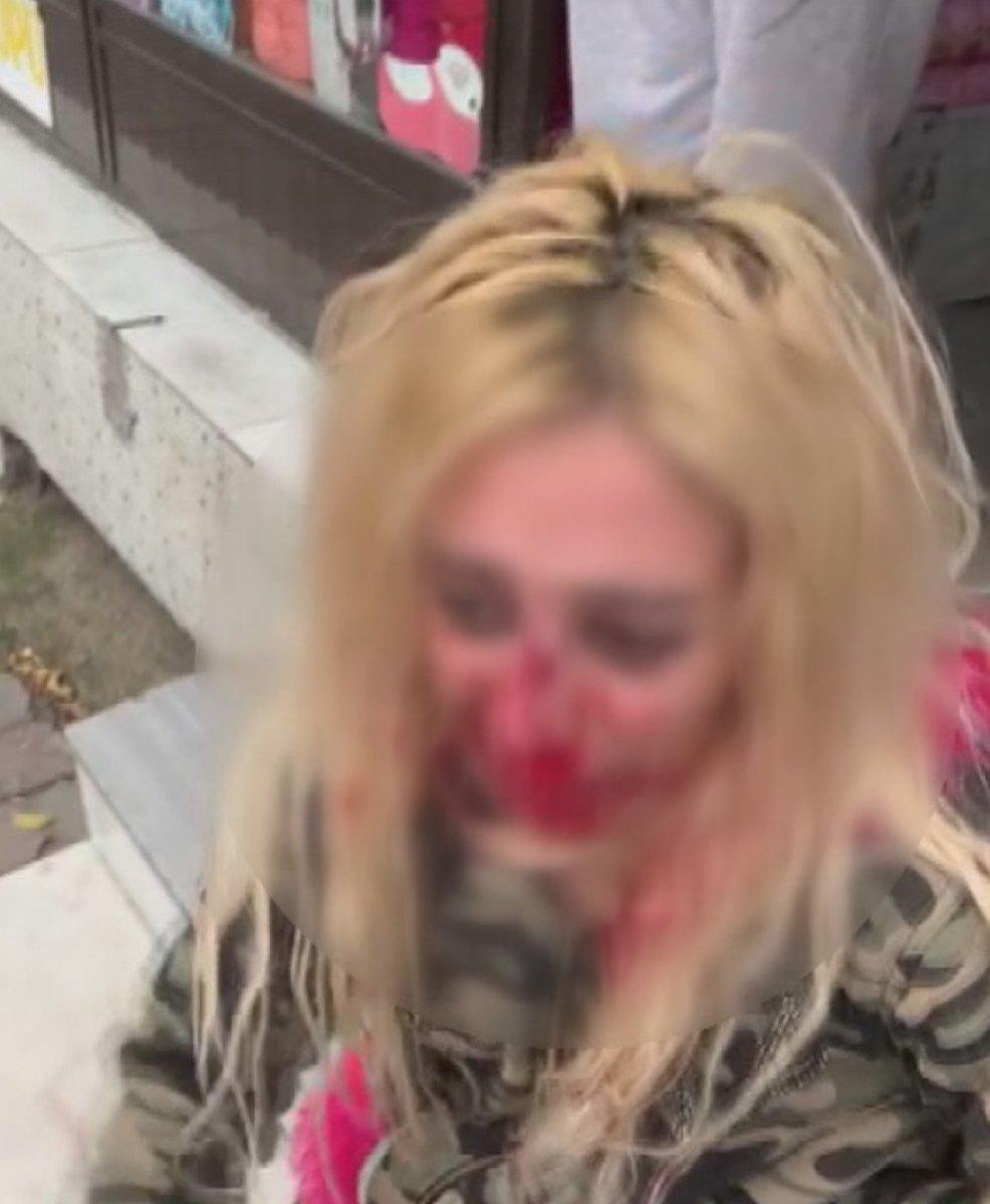 Gaziosmanpaşa'da darbedilen kadın kanlar içinde yola bırakıldı