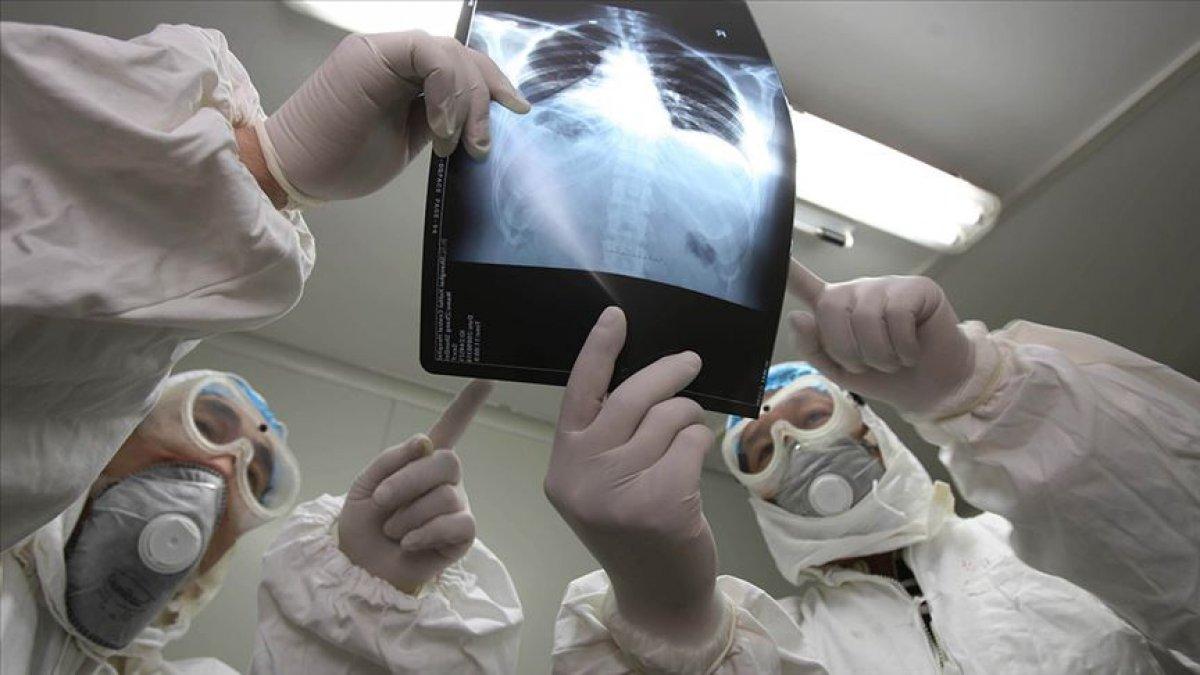 Sars virüsü nedir? Çin'de tekrar görülen Sars virüsü nasıl bulaşır? Belirtileri nelerdir?