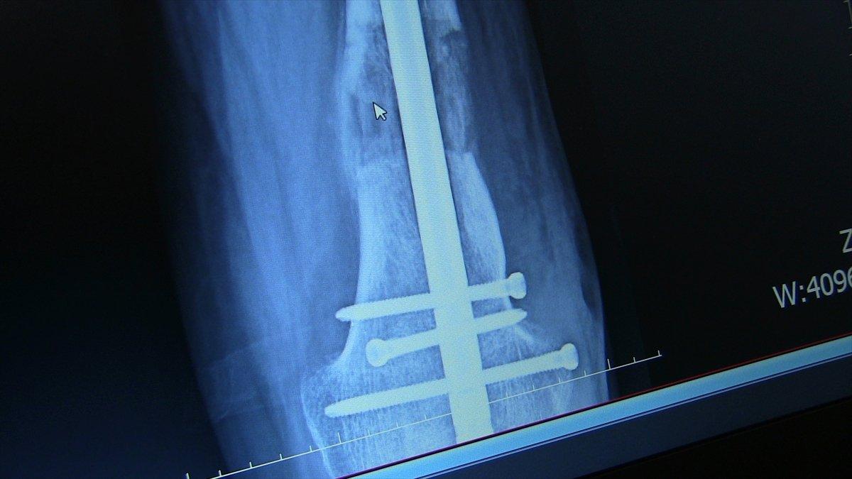 Konyalı İyigökler, hasret kaldığı ayakkabılara 31 yıl sonra kavuştu