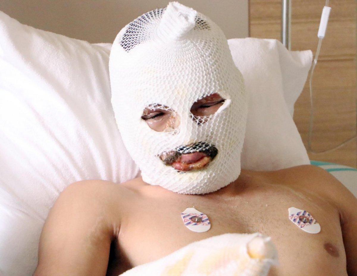 Yusufeli'nin Barhal köyünde korkutan yangın