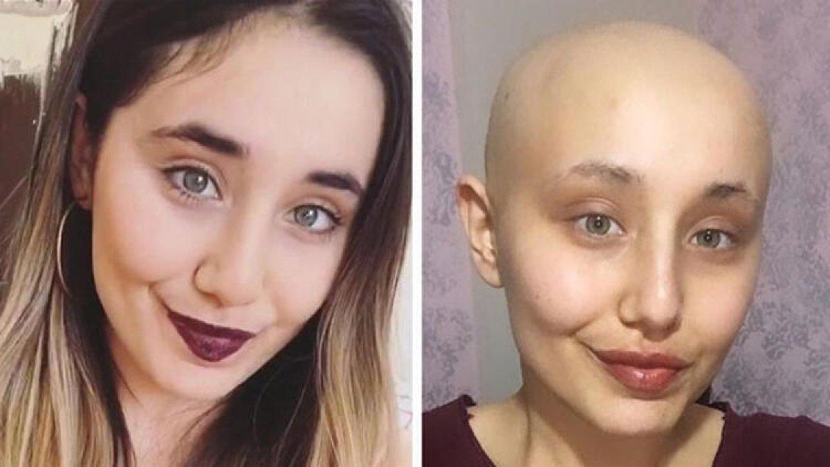 Ayyüce Çınar kimdir, kaç yaşındaydı? Neslican Tay'a benzetilen Ayyüce Çınar'ın hastalığı neydi?