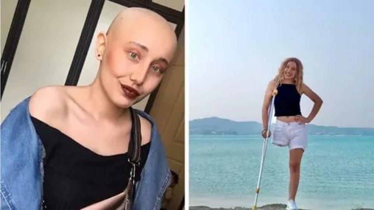 Ayyüce Çınar kimdir, kaç yaşındaydı? Neslican Tay'a benzetilen Ayyüce Çınar'ın hastalığı neydi?