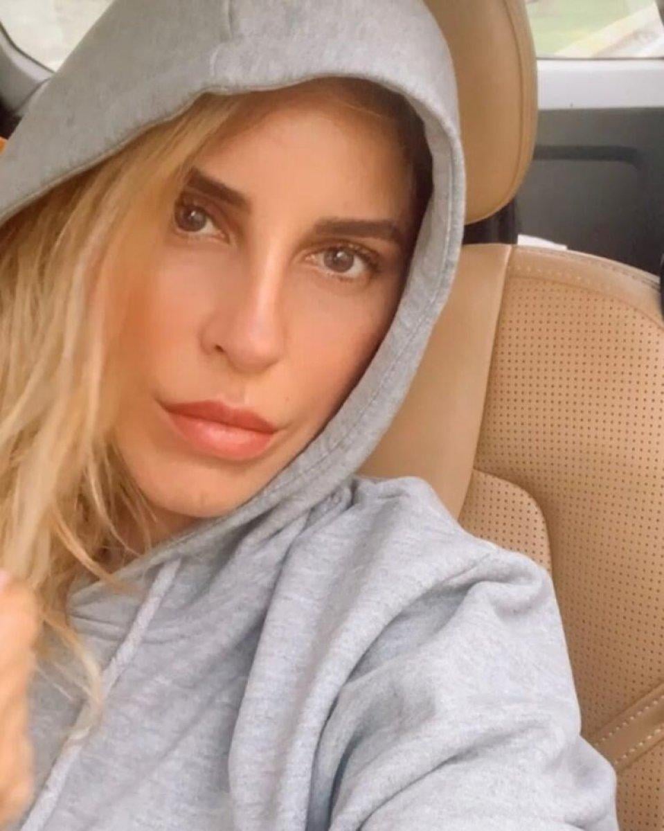 Irmak Ünal: Akciğerim eski haline dönmedi