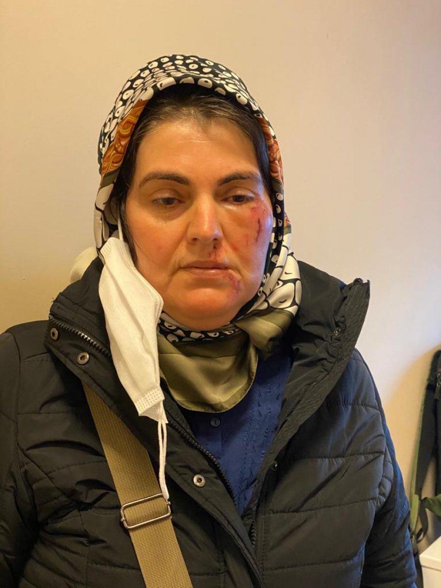 Maltepe'de alışverişten dönen kadın saldırıya uğradı