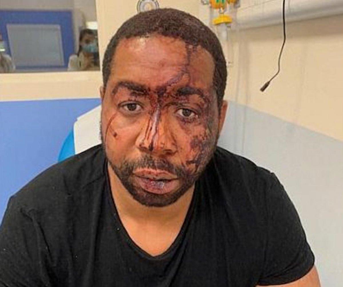 Emmanuel Macron: Polis şiddeti hepimiz için utanç verici