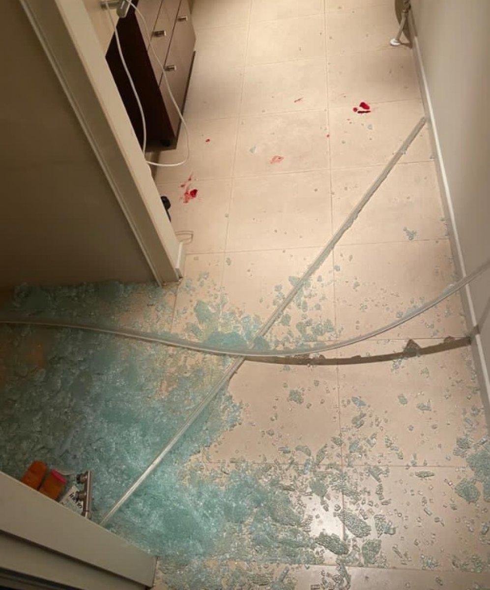 Sydney van Hooijdonk duşta mahsur kalınca ayaklarını parçaladı