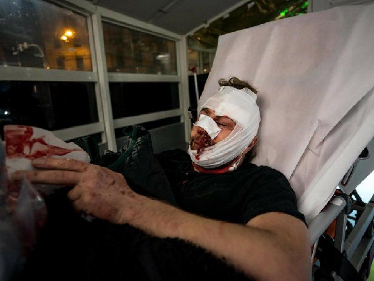 Fransa'da gazeteciye polis şiddeti